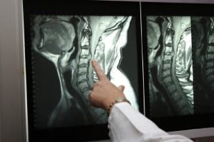 X-ray leher
