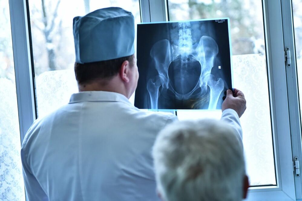 Doktor melihat gambar sendi pinggul dengan osteoarthritis